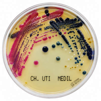 CHROMOGENIC UTI AGAR